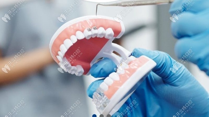 正畸专用牙刷与牙线搭配技巧：如何维护口腔健康**
